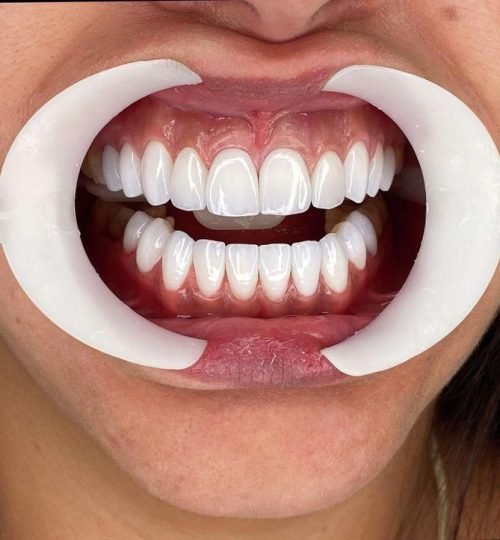 WhatsApp Image 2025-05-23 at 11.41.22 AM (1)