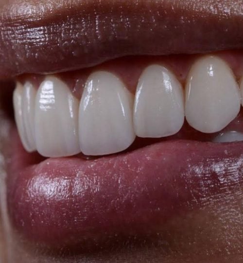 WhatsApp Image 2025-05-23 at 11.41.22 AM (3)