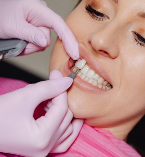 Close-up of a dental veneer being applied to a woman's teeth at a clinic.